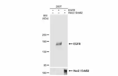 Anti-EGFR antibody [GT133] used in Western Blot (WB). GTX628887
