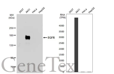 Anti-EGFR antibody [GT133] used in Western Blot (WB). GTX628887