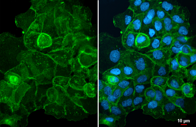Anti-EGFR antibody [GT133] used in Immunocytochemistry/ Immunofluorescence (ICC/IF). GTX628887