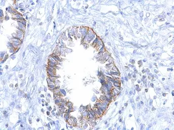 Anti-EGFR antibody [GT133] used in IHC (Paraffin sections) (IHC-P). GTX628887