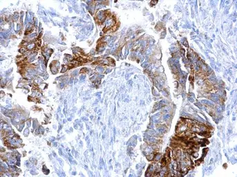 Anti-EGFR antibody [GT133] used in IHC (Paraffin sections) (IHC-P). GTX628887