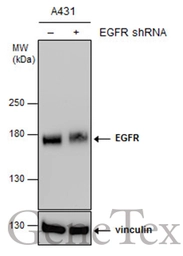 Anti-EGFR antibody [GT461] used in Western Blot (WB). GTX628888