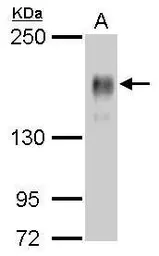 Anti-EGFR antibody [GT461] used in Western Blot (WB). GTX628888