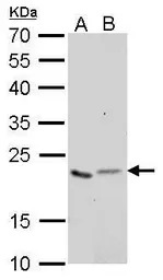 Anti-Glyoxalase I antibody [GT552] used in Western Blot (WB). GTX628890