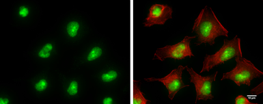 Anti-ADAR1 antibody [GT1066] used in Immunocytochemistry/ Immunofluorescence (ICC/IF). GTX629000
