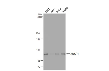 Anti-ADAR1 antibody [GT1066] used in Western Blot (WB). GTX629000