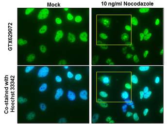 Anti-NuMA antibody [GT1510] used in Immunocytochemistry/ Immunofluorescence (ICC/IF). GTX629072