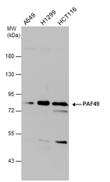 Anti-PAF49 antibody [GT7212] used in Western Blot (WB). GTX629075