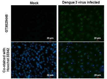 Anti-Dengue virus NS5 protein antibody [GT353] used in Immunocytochemistry/ Immunofluorescence (ICC/IF). GTX629446