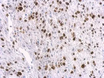 Anti-HMGA2 antibody [GT763] used in IHC (Paraffin sections) (IHC-P). GTX629478