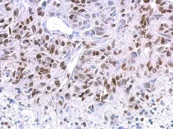 Anti-HMGA2 antibody [GT763] used in IHC (Paraffin sections) (IHC-P). GTX629478