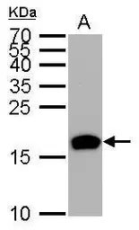 Anti-HMGA2 antibody [GT763] used in Western Blot (WB). GTX629478