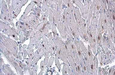 Anti-HMGA2 antibody [GT763] used in IHC (Paraffin sections) (IHC-P). GTX629478