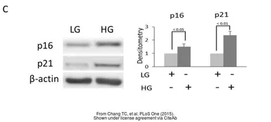Anti-p21 Cip1 antibody [GT1032] used in Western Blot (WB). GTX629543