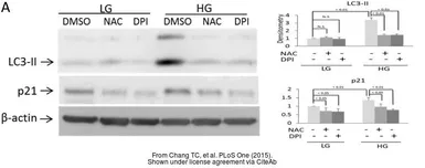 Anti-p21 Cip1 antibody [GT1032] used in Western Blot (WB). GTX629543