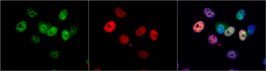 Anti-p21 Cip1 antibody [GT1032] used in Immunocytochemistry/ Immunofluorescence (ICC/IF). GTX629543