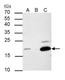 Anti-p21 Cip1 antibody [GT1032] used in Immunoprecipitation (IP). GTX629543