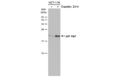 Anti-p21 Cip1 antibody [GT1032] used in Western Blot (WB). GTX629543