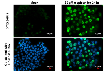Anti-p21 Cip1 antibody [GT1032] used in Immunocytochemistry/ Immunofluorescence (ICC/IF). GTX629543
