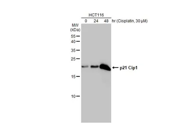 Anti-p21 Cip1 antibody [GT1032] used in Western Blot (WB). GTX629543