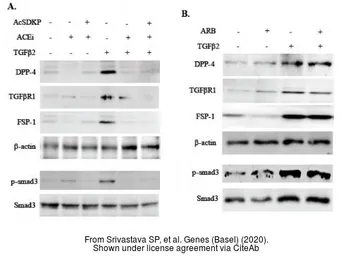 Anti-beta Actin antibody [GT5512] used in Western Blot (WB). GTX629630