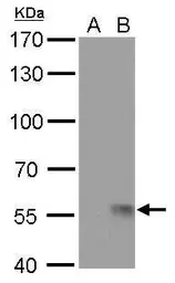 Anti-Influenza A virus H1N1 NA (Neuraminidase) antibody [GT172] used in Western Blot (WB). GTX629695