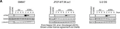 Anti-ATRX antibody [GT4212] used in Western Blot (WB). GTX629703