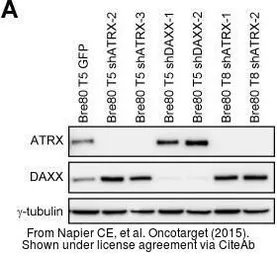 Anti-ATRX antibody [GT4212] used in Western Blot (WB). GTX629703