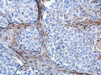 Anti-Vimentin antibody [GT7812] used in IHC (Paraffin sections) (IHC-P). GTX629743