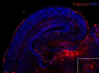 Anti-Vimentin antibody [GT7812] used in IHC (Frozen sections) (IHC-Fr). GTX629743