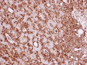 Anti-Vimentin antibody [GT7812] used in IHC (Paraffin sections) (IHC-P). GTX629743