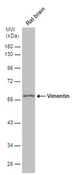 Anti-Vimentin antibody [GT7812] used in Western Blot (WB). GTX629743