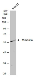 Anti-Vimentin antibody [GT7812] used in Western Blot (WB). GTX629743