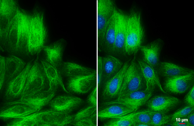 Anti-Vimentin antibody [GT7812] used in Immunocytochemistry/ Immunofluorescence (ICC/IF). GTX629743