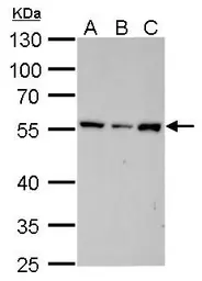 Anti-Vimentin antibody [GT7812] used in Western Blot (WB). GTX629743