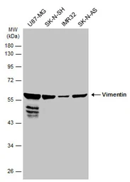 Anti-Vimentin antibody [GT7812] used in Western Blot (WB). GTX629743