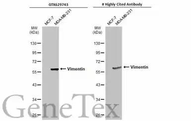 Anti-Vimentin antibody [GT7812] used in Western Blot (WB). GTX629743
