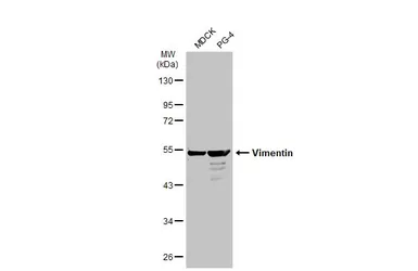 Anti-Vimentin antibody [GT7812] used in Western Blot (WB). GTX629743