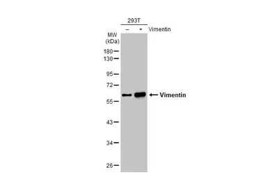Anti-Vimentin antibody [GT7812] used in Western Blot (WB). GTX629743