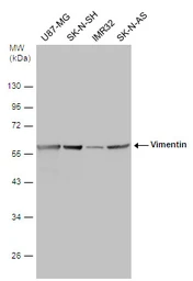Anti-Vimentin antibody [GT812] used in Western Blot (WB). GTX629744
