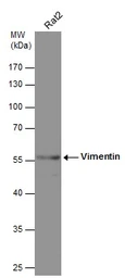 Anti-Vimentin antibody [GT812] used in Western Blot (WB). GTX629744