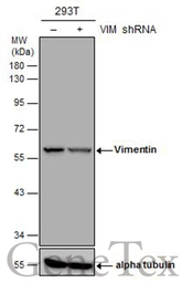 Anti-Vimentin antibody [GT812] used in Western Blot (WB). GTX629744
