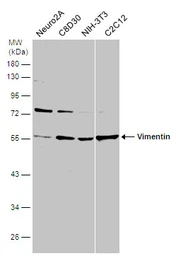 Anti-Vimentin antibody [GT812] used in Western Blot (WB). GTX629744