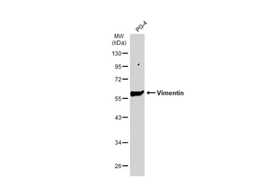 Anti-Vimentin antibody [GT812] used in Western Blot (WB). GTX629744