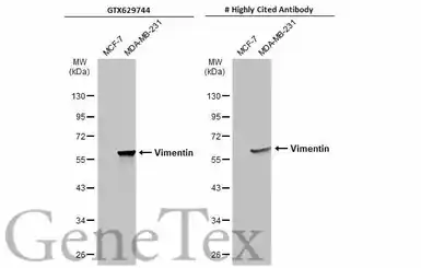Anti-Vimentin antibody [GT812] used in Western Blot (WB). GTX629744