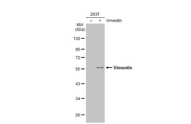 Anti-Vimentin antibody [GT812] used in Western Blot (WB). GTX629744