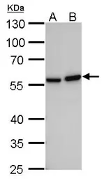 Anti-Vimentin antibody [GT812] used in Western Blot (WB). GTX629744