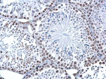 Anti-5-Hydroxymethylcytosine / 5-hmC antibody [GT13612] used in IHC (Paraffin sections) (IHC-P). GTX629765