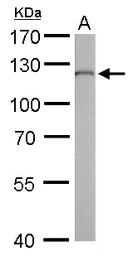 Anti-O-GlcNAc transferase antibody [GT678] used in Western Blot (WB). GTX629812