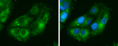 Anti-IDH1 antibody [GT1521] used in Immunocytochemistry/ Immunofluorescence (ICC/IF). GTX629818